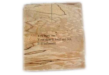 You Burn Me